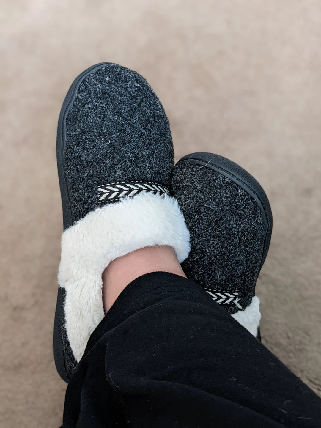 Comfort Solutions for Bunion Correction and Pain Relief