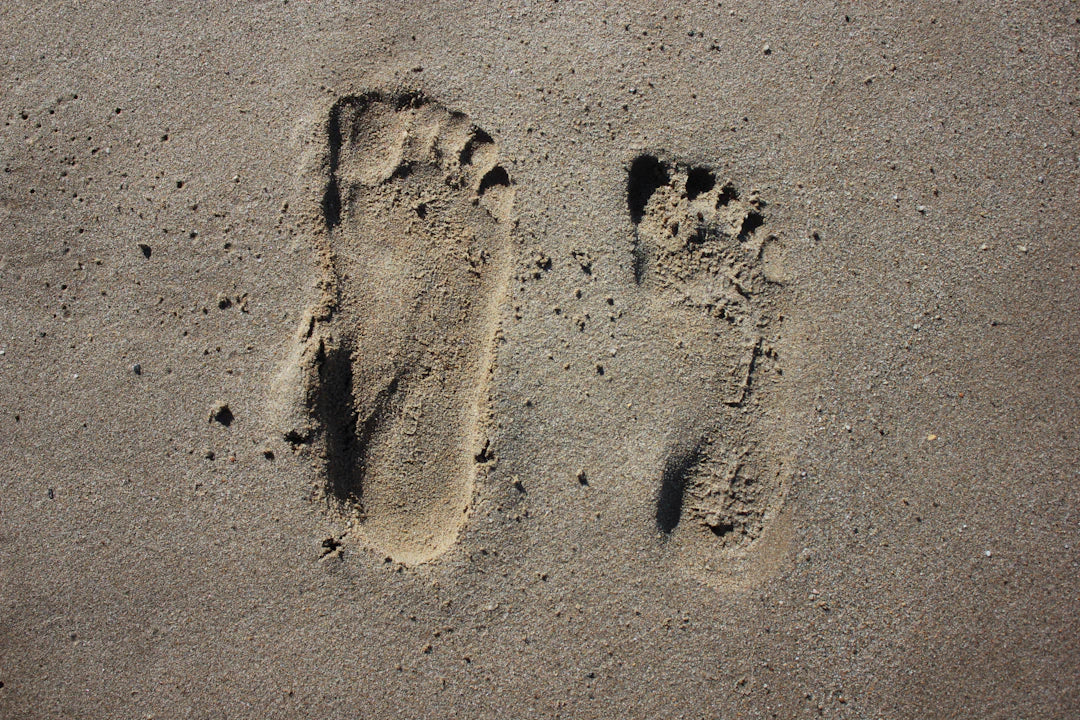 Essential Foot Care Tips to Prevent Bunions