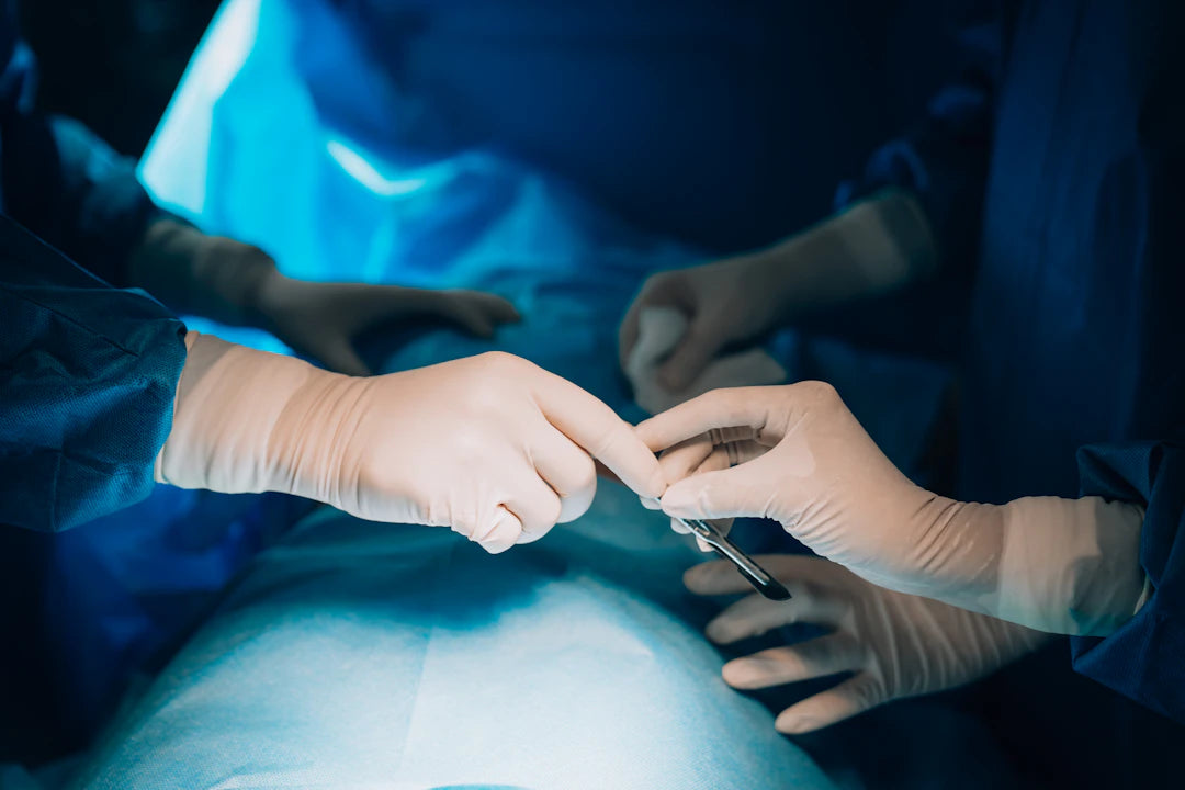Surgical Options for Bunion Correction What to Expect