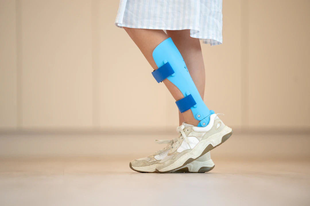 Essential Guide Recovery Process After Bunion Surgery