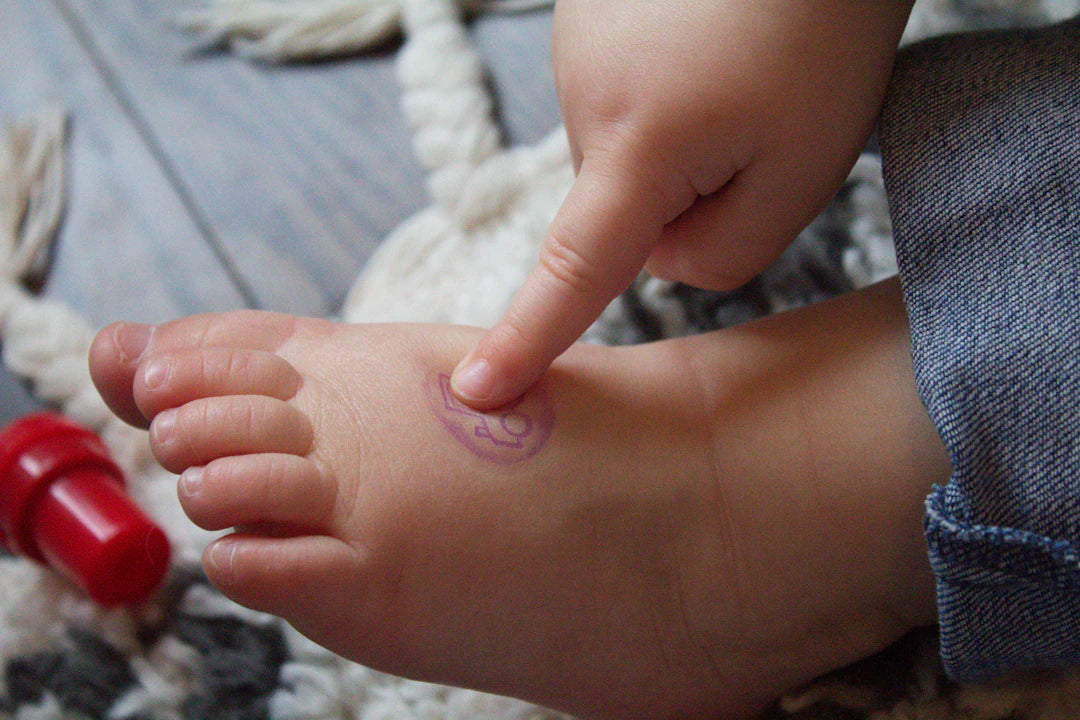 Bunions in Children Essential Insights for Parents