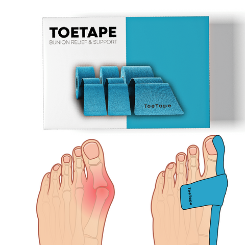 Bunion Relief Tape