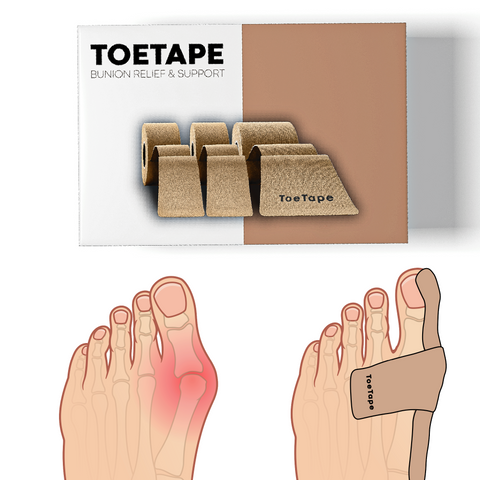 Bunion Relief Tape